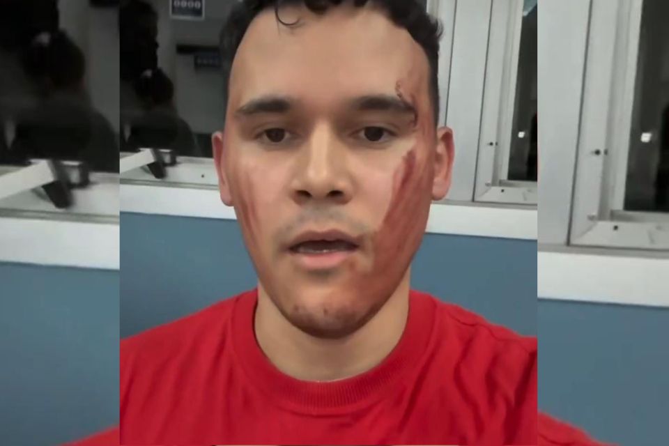/Reprodu&ccedil;&atilde;o/ Redes Sociais
